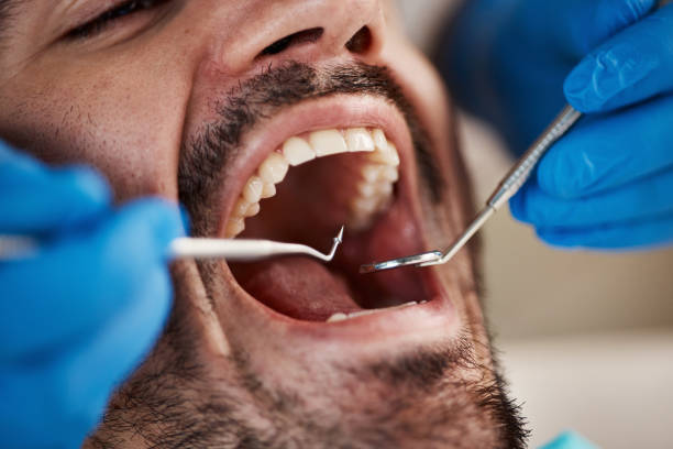 Best Oral Cancer Screening  in The Village Of Indian Hill, OH